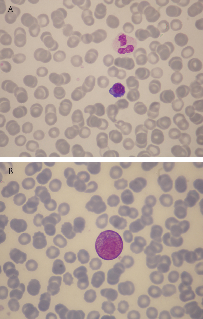 Red Blood Cell Morphology Test Purpose, Procedure, Result and many more